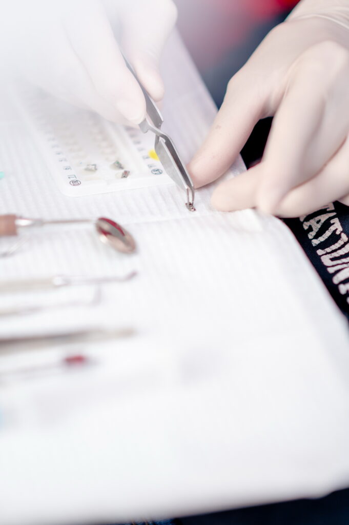 Leczenie kanałowe pod mikroskopem - 2025.05.15 estetica clinic rawa mazowiecka